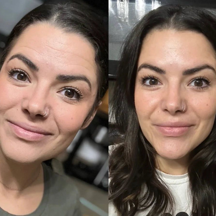 NORDERMA Anti-rynke plaster